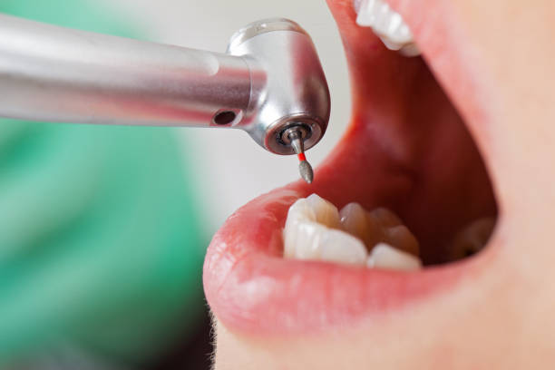 Best Broken or Cracked Tooth Emergency Dentist in Emerald Isle, NC